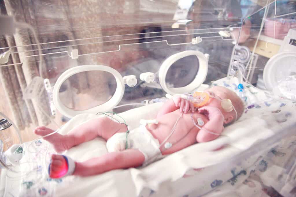 Premature baby in incubator.
